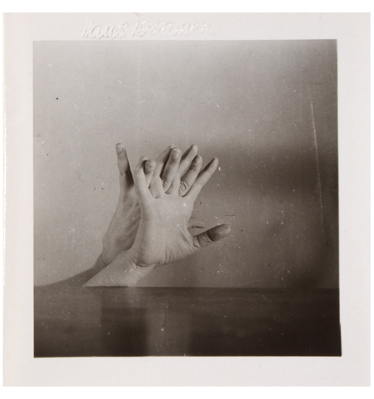 A photograph of two hands with splayed and interlaced fingers, with one palm facing the viewer. The hands are seen from the wrist up, as if the rest of the arm is behind the table.